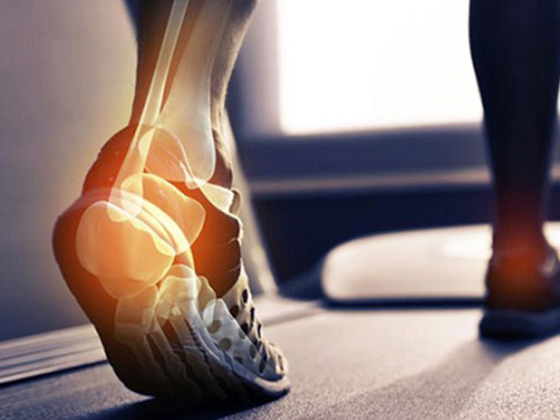 saúde dos pés evitar esporão de calcanhar